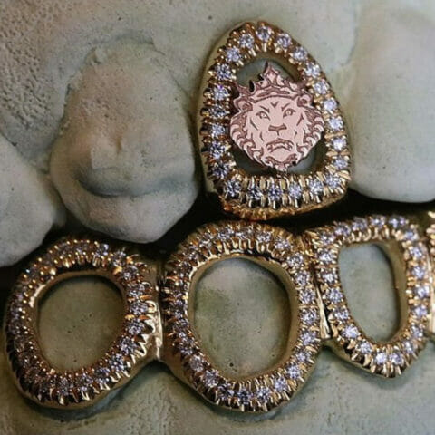 敢不敢来一款“壕无人性”的镶钻牙饰